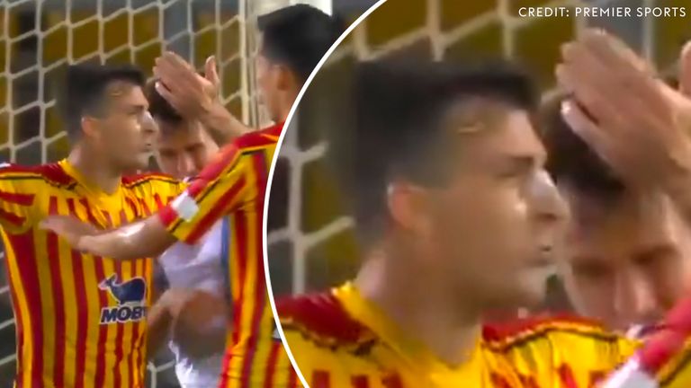 Image of apparent bite from Lazio player Patric (Credit: Premier Sports)